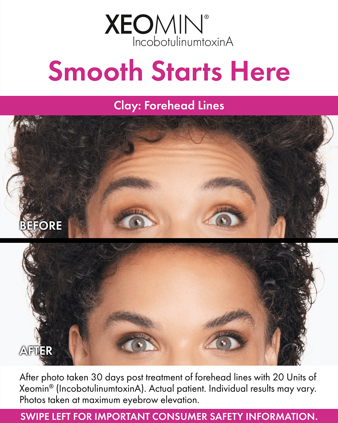 Before&AfterPosts-Clay-0