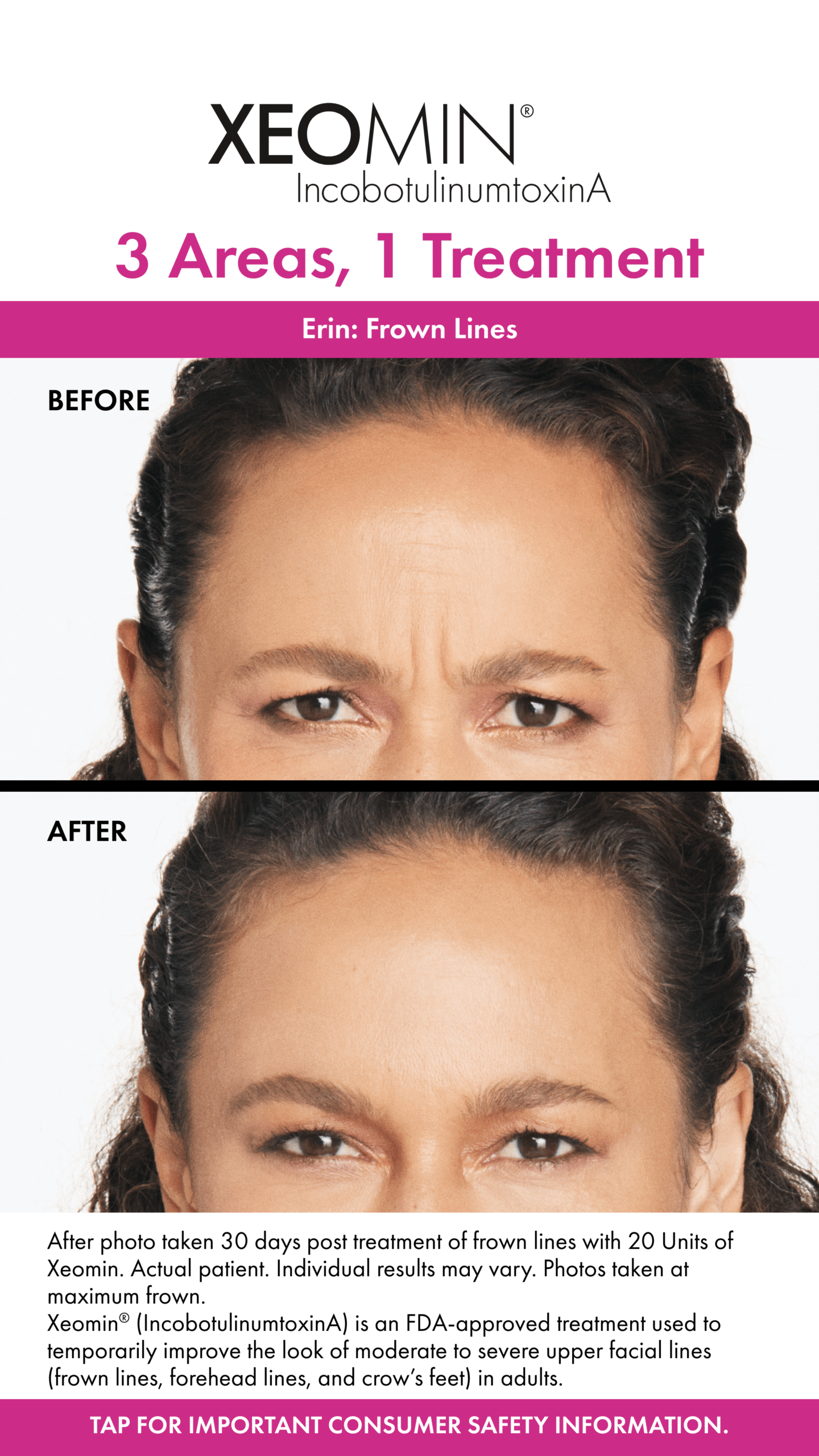 Before&AfterStory-Erin-1