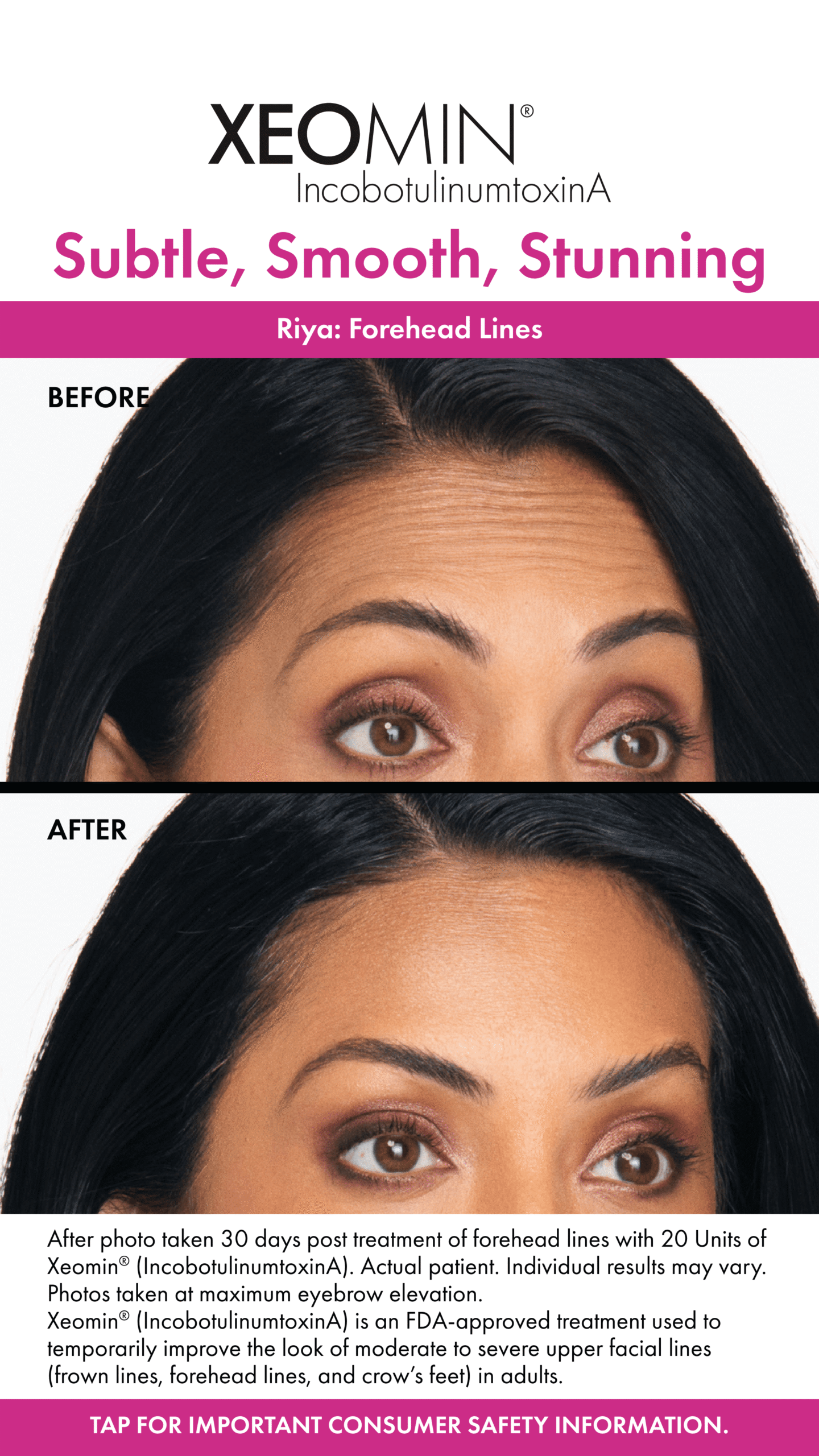 Before&AfterStory-Riya-0