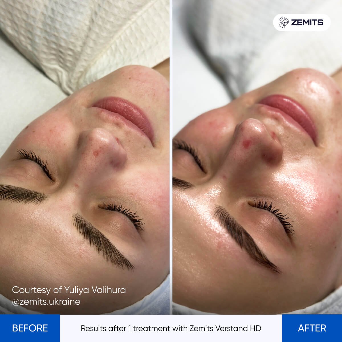 Results_after_1_trea-2