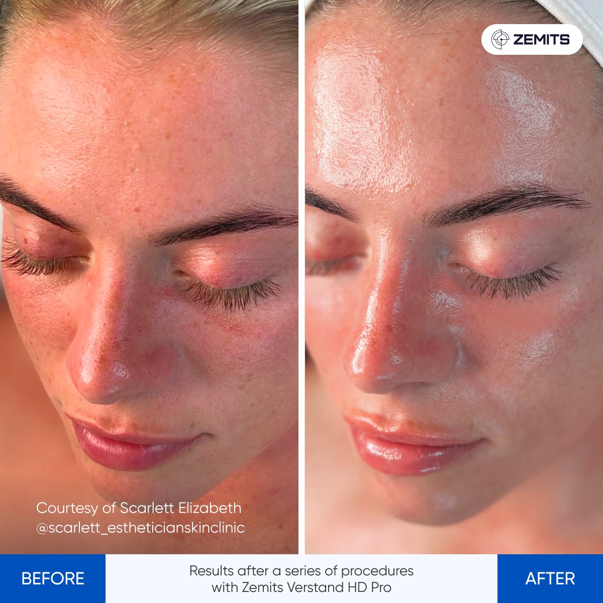 Results_after_a_seri-2