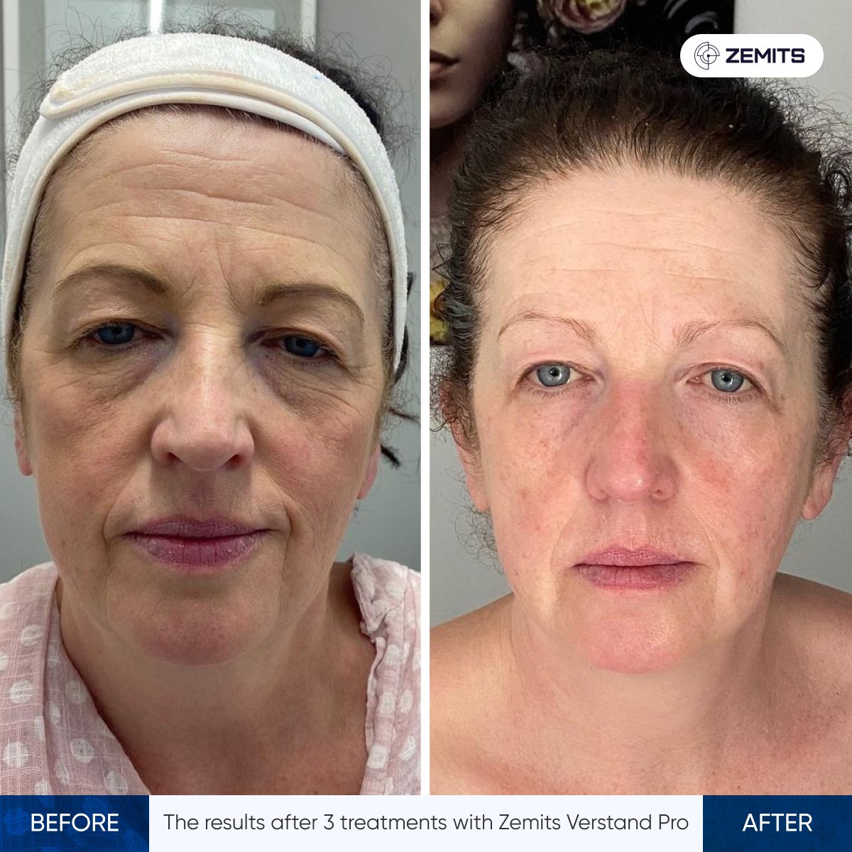 Zemits_Verstand_Pro-