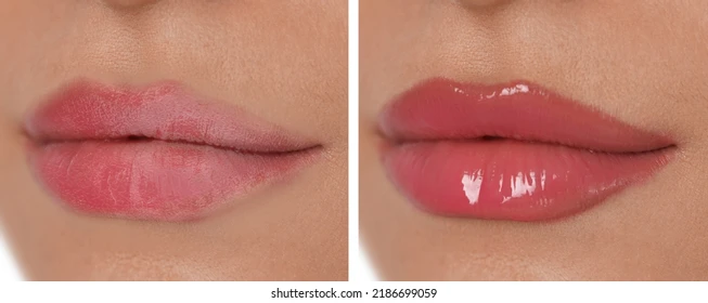 collage-photos-woman-dry-moisturized-260nw-2186699059