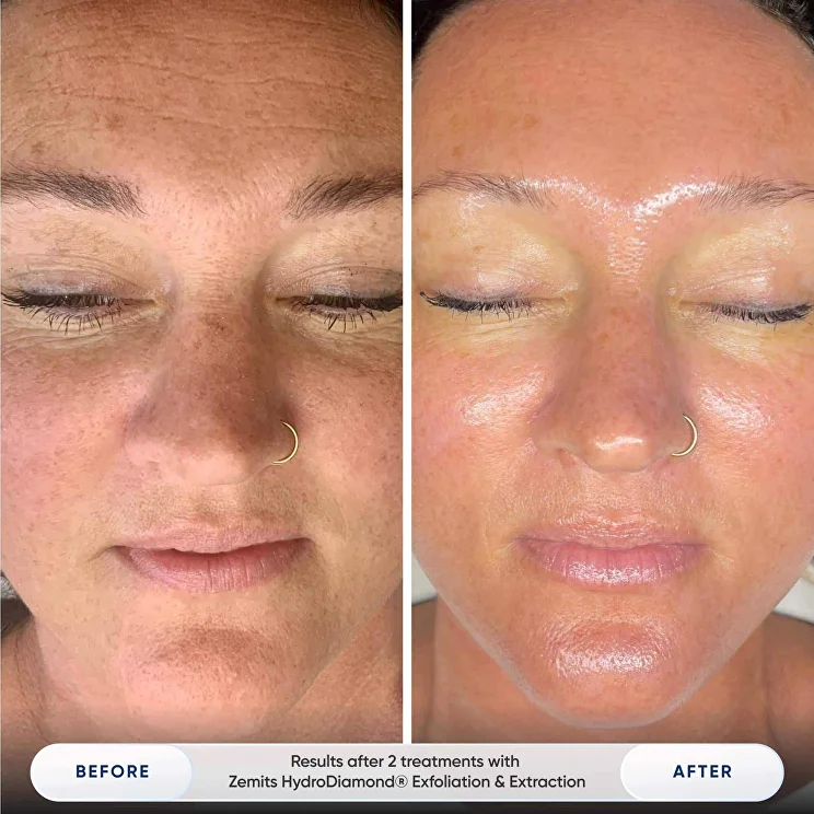 verstandhdpro_landin